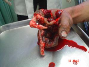post-149397-1199984171_thumb.jpg