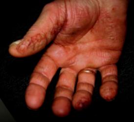 post-184293-0-96793200-1296085828_thumb.jpg
