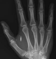 post-224880-0-80780600-1298310875_thumb.jpg
