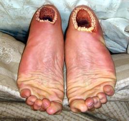 post-132512-1236558999_thumb.jpg