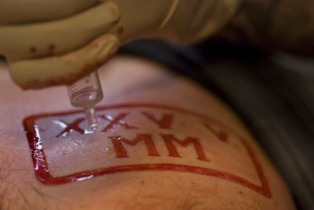 Bilderesultat for scarification norge
