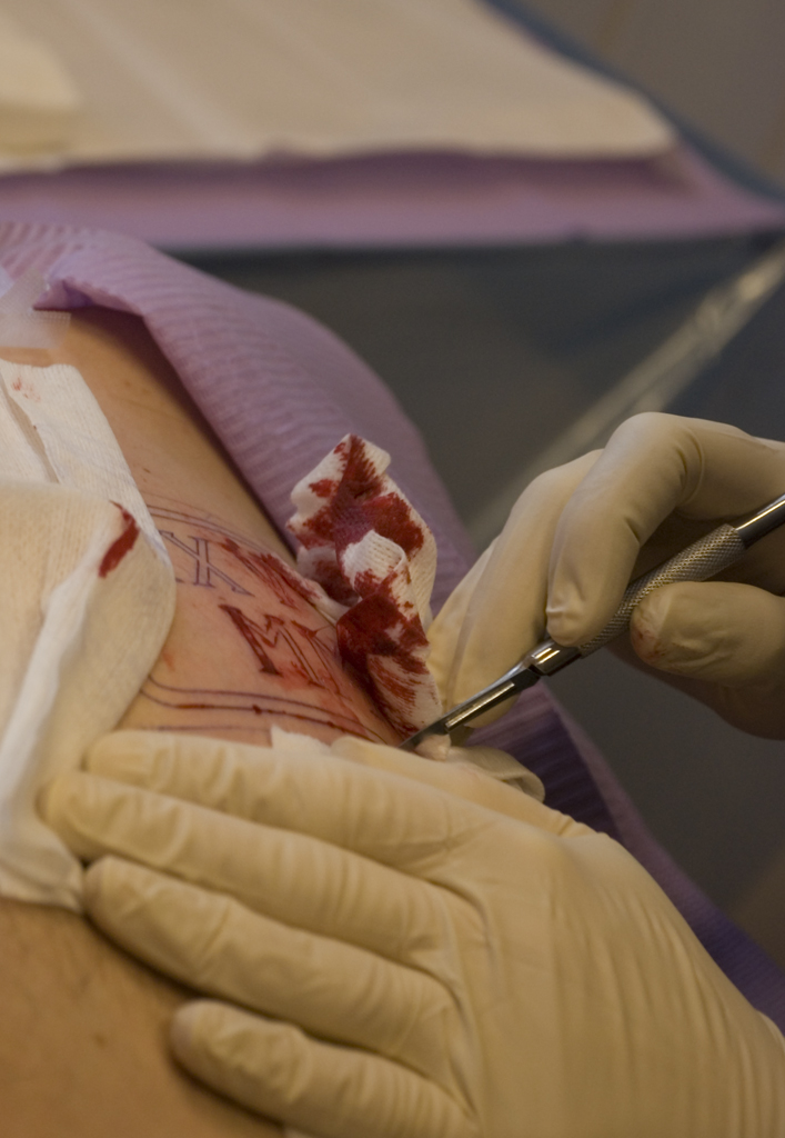 Bilderesultat for scarification norge