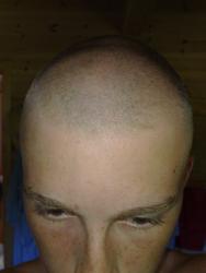 post-151236-1216917740_thumb.jpg