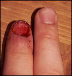 post-86073-1218884420_thumb.jpg