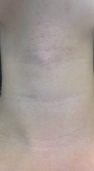 post-443450-0-39854700-1502045053_thumb.png