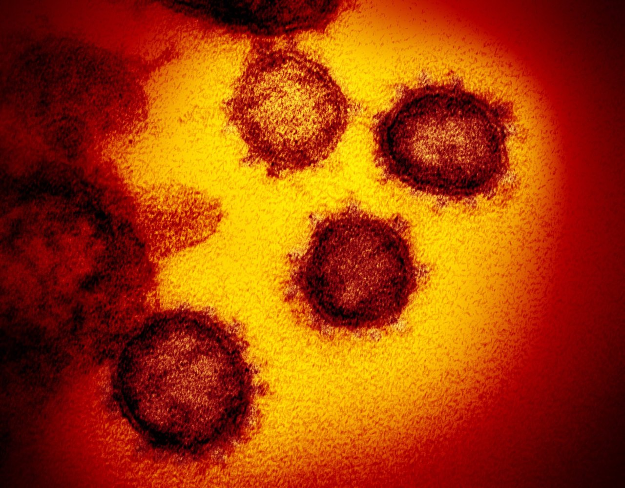 novel-coronavirus-sars-cov-2_49530315718_o_custom-5ffcb61ae98df99b4444a71792e96da7ffbf77ff.thumb.jpg.84b075fc394a82b2a2fda6e157367129.jpg