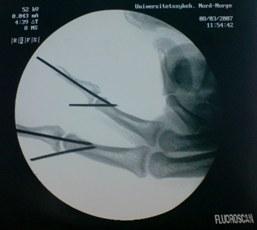 post-15715-1173414752_thumb.jpg