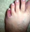 post-22981-1177665766_thumb.jpg
