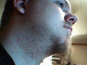 post-23984-1173908398_thumb.jpg