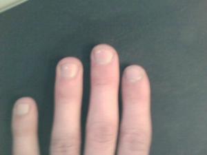 post-25827-1174919044_thumb.jpg
