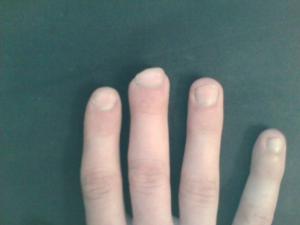 post-25827-1174919056_thumb.jpg