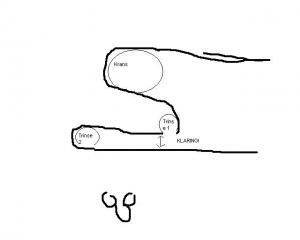 post-27757-1179677547_thumb.jpg