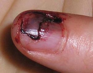 post-63-1098821136_thumb.jpg